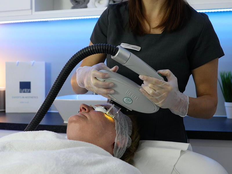 IPL Skin Rejuvenation Facial